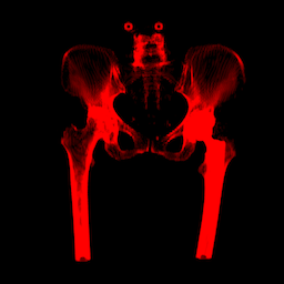 Rendered x-rax image of a Hip.